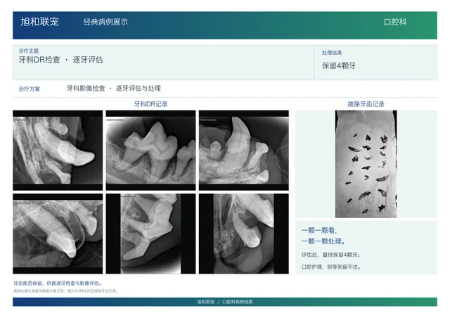 牙科 DR 检查与逐牙评估病例展示图