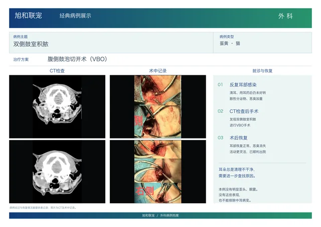 双侧鼓室积脓病例展示图