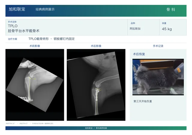 TPLO 胫骨平台水平截骨术病例展示图