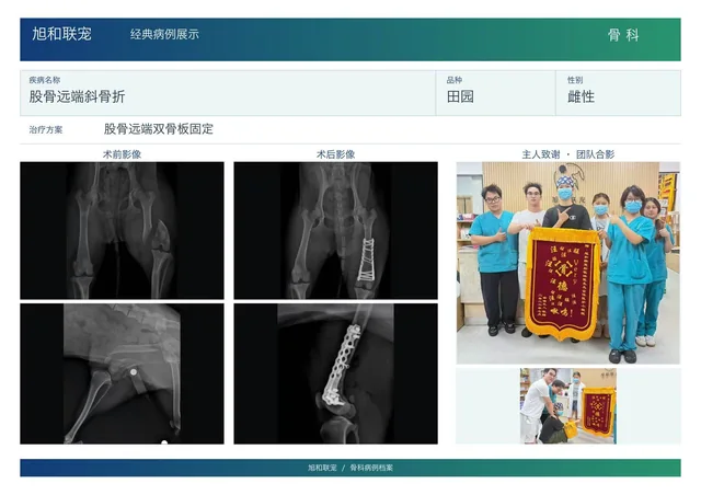股骨远端斜骨折病例展示图