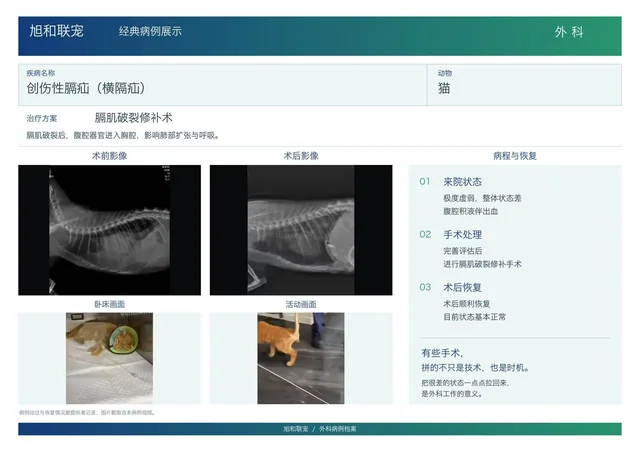 创伤性膈疝病例展示图