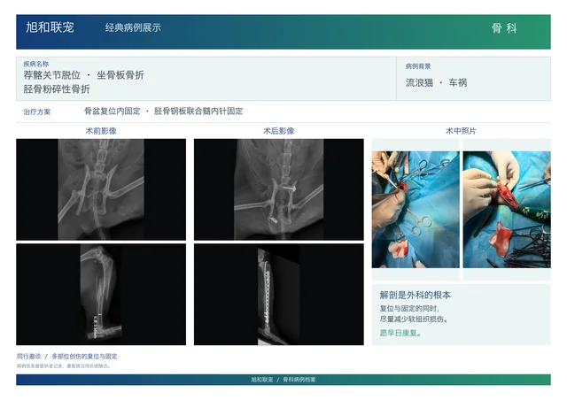多部位创伤 · 骨盆与胫骨固定病例展示图